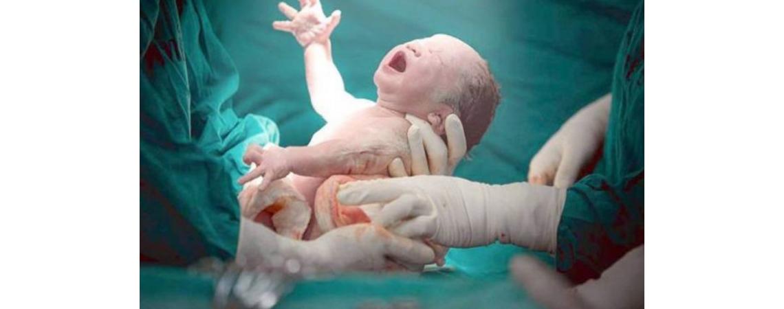 في حالة شذوذ طبي &quot;جنين داخل الجنين&quot; .. مولودة &quot;حبلى&quot; تخضع لعملية
